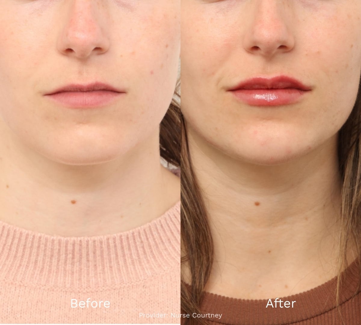Before and After Result