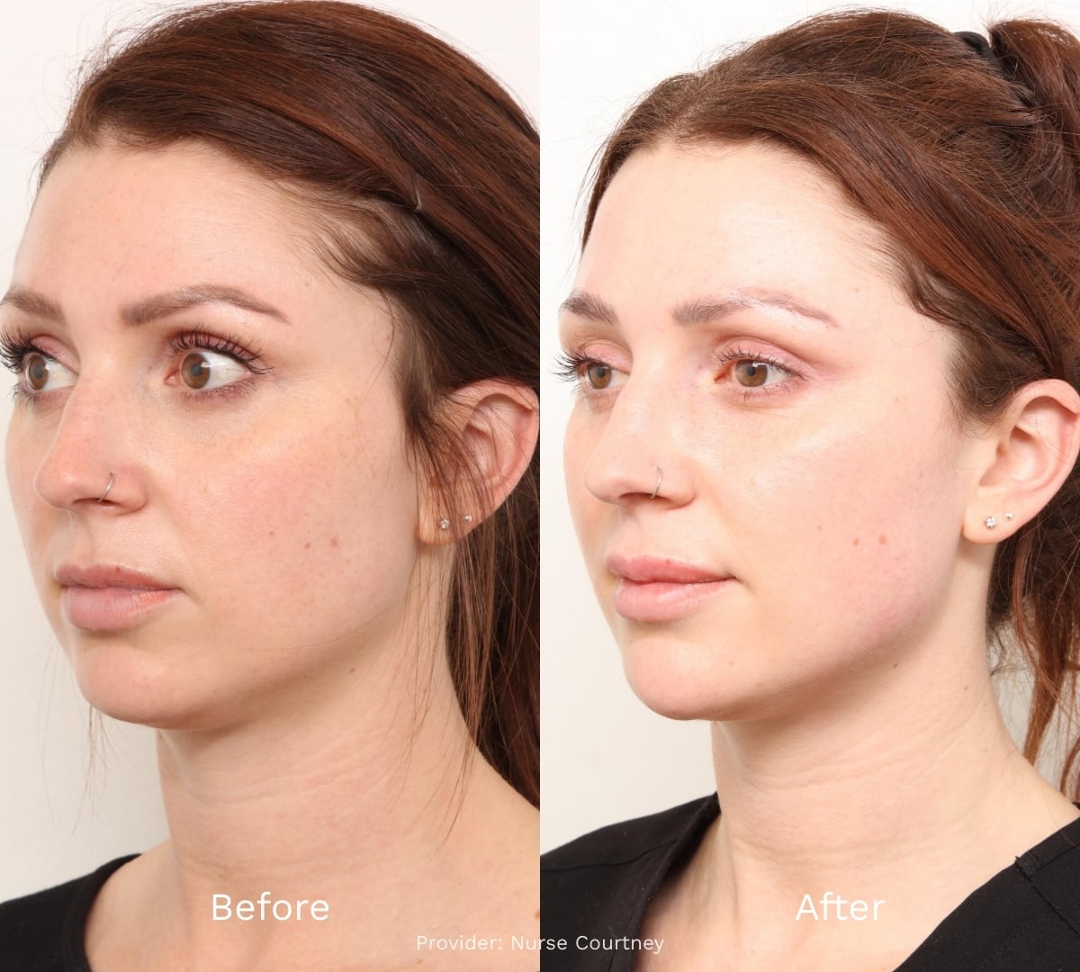 Before and After Result