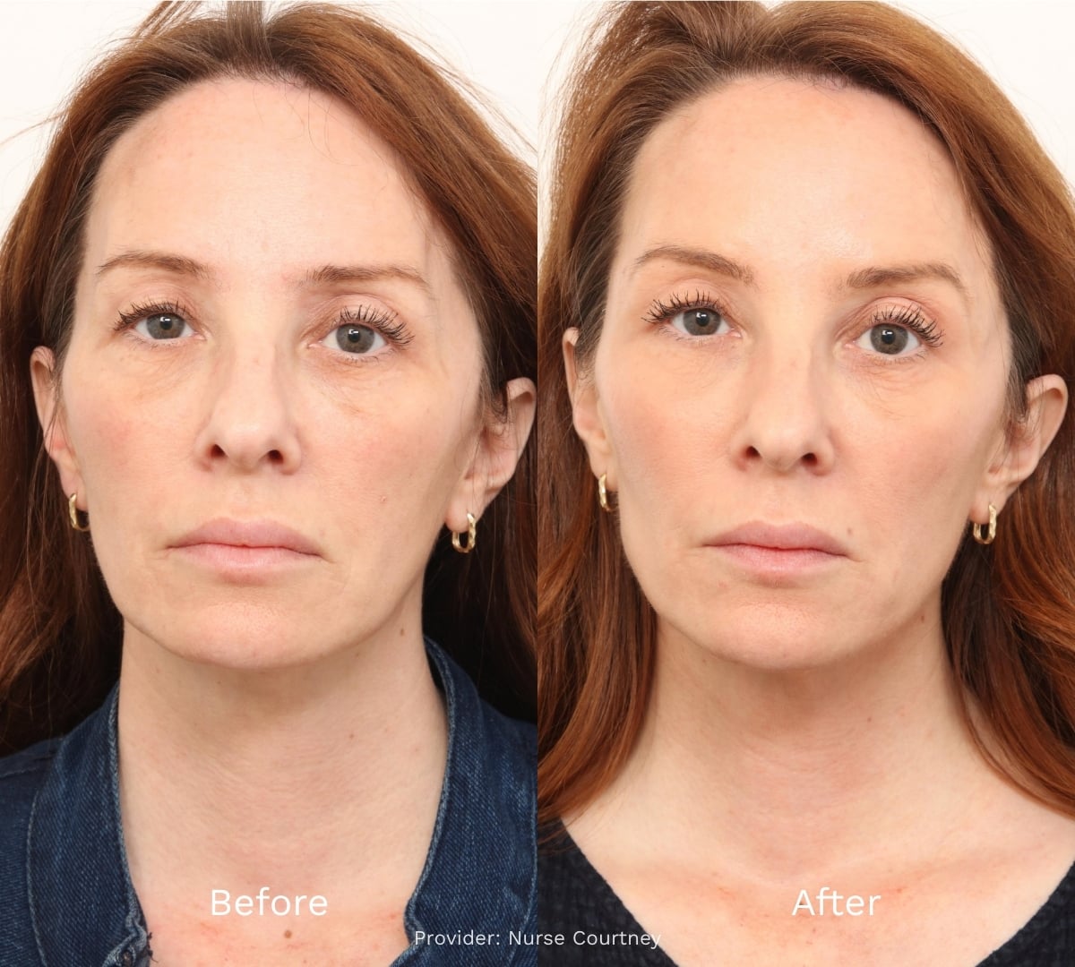 Before and After Result