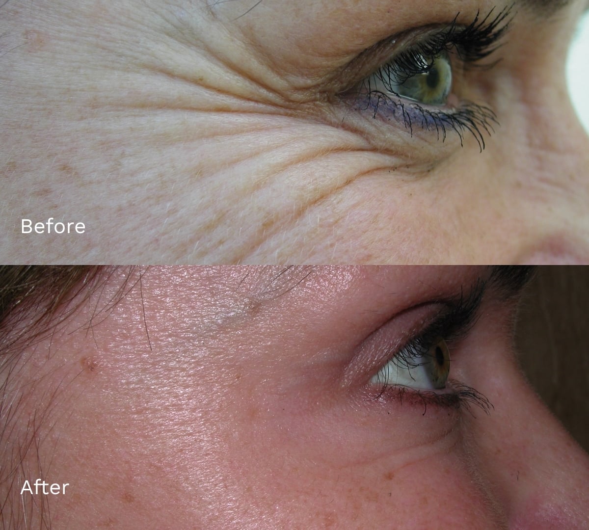 Before and After Result